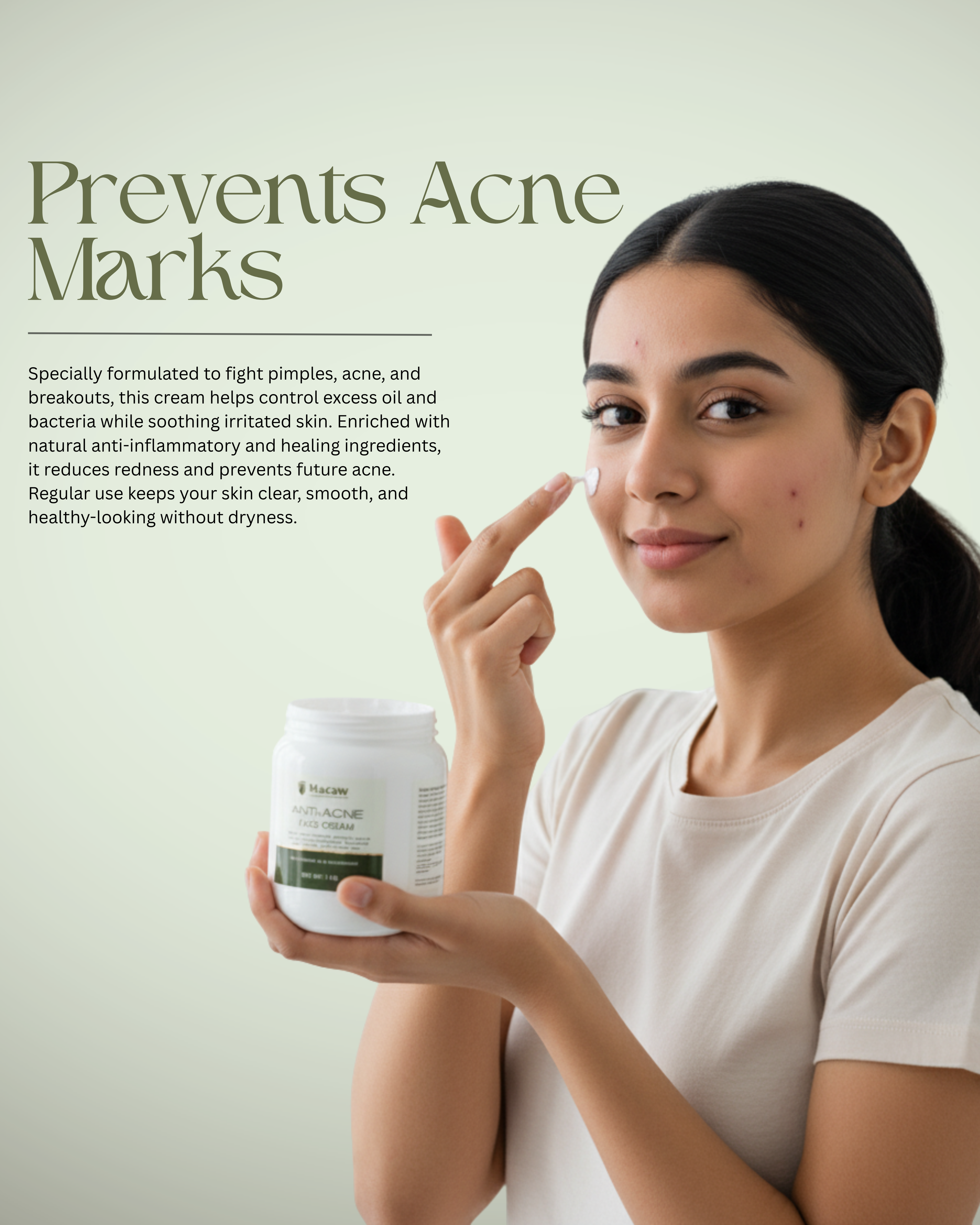 Anti-Acne Face Cream